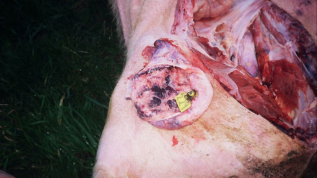 <p>Cystitis&nbsp;caused by&nbsp;<em>E. coli</em></p>
